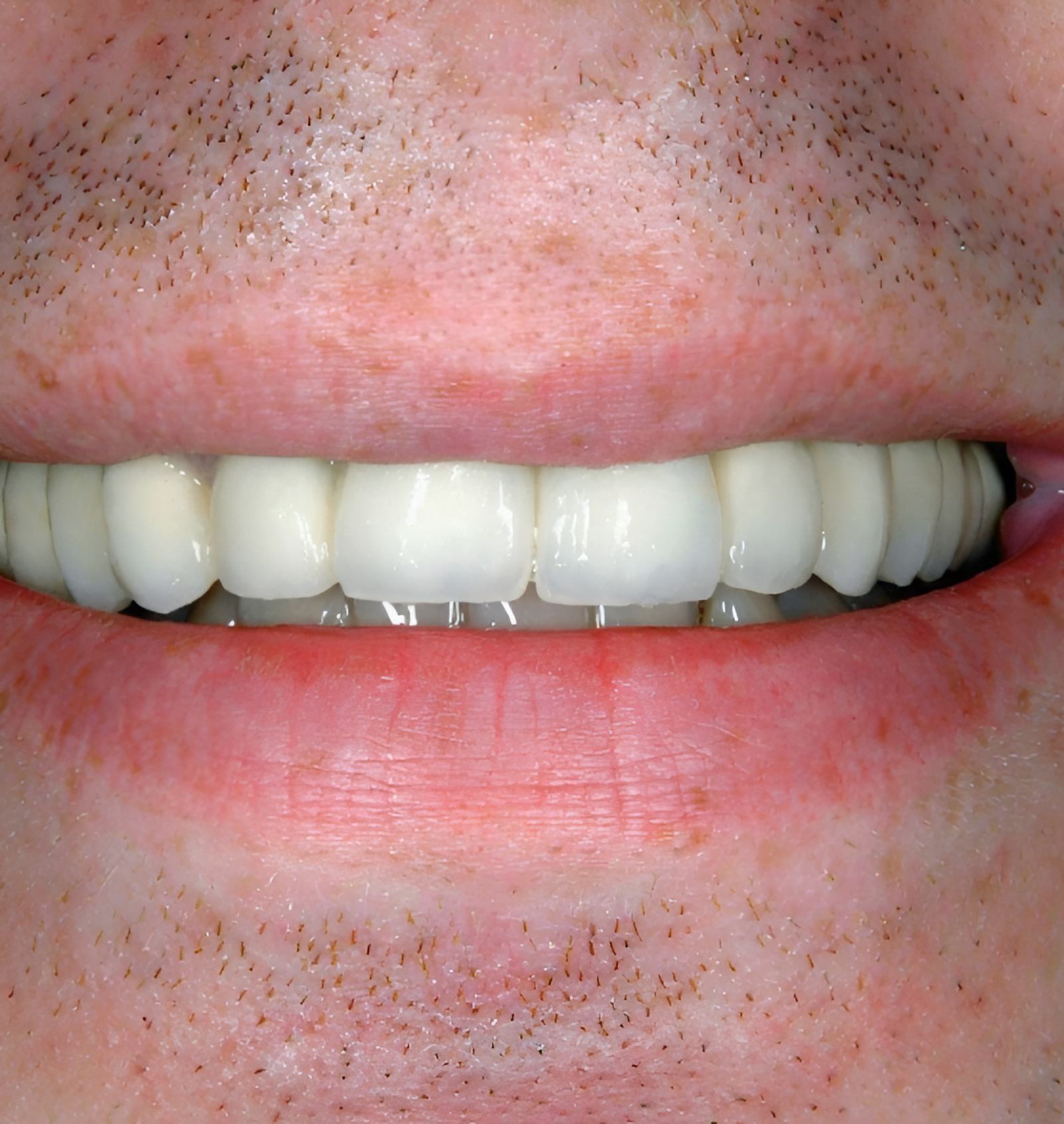 11-Picsart-AiImageEnhancer