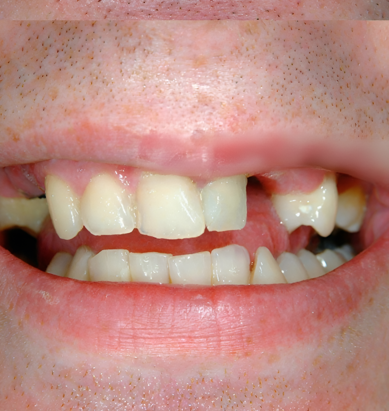 222-Picsart-AiImageEnhancer